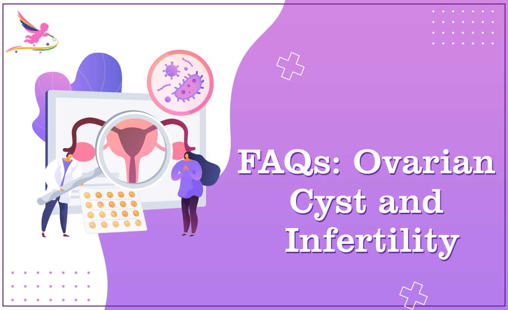 FAQs: Ovarian Cyst and Infertility
